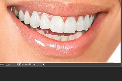 PS牙齿怎么变白 5个步骤教你美白牙齿