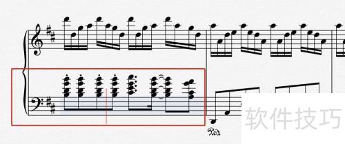 Overture��ô�޸��׺�