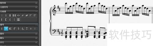 Overture��ô�޸��׺�