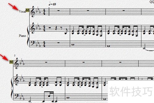 Overture��ô�ر�����