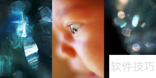 孕妈怎么做眼保健操 孕妈怎么做眼保健操