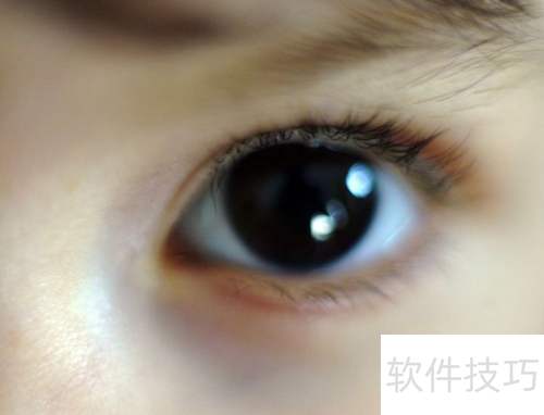 孕妈怎么做眼保健操 孕妈怎么做眼保健操