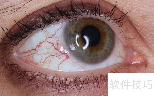 做眼保健操有用吗 做眼保健操有用吗