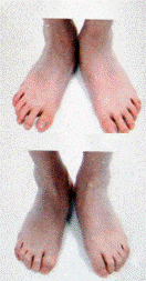 眼保健操步骤分享 眼保健操步骤分享