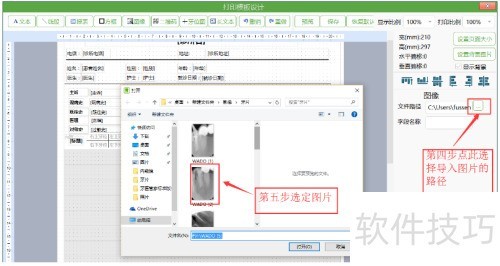 牙医管家口腔管理软件怎么打印口腔病历? 牙医管家口腔管理软件怎么打印口腔病历?