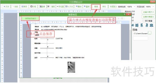 牙医管家口腔管理软件怎么打印口腔病历? 牙医管家口腔管理软件怎么打印口腔病历?