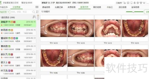 口腔管理软件影像自动导入操作方法-牙医管家 口腔管理软件影像自动导入操作方法-牙医管家