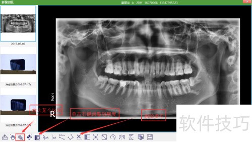 牙医管家影像信息主界面有哪些功能 牙医管家影像信息主界面有哪些功能