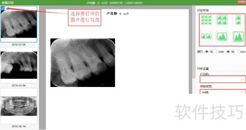 牙医管家影像信息主界面有哪些功能 牙医管家影像信息主界面有哪些功能