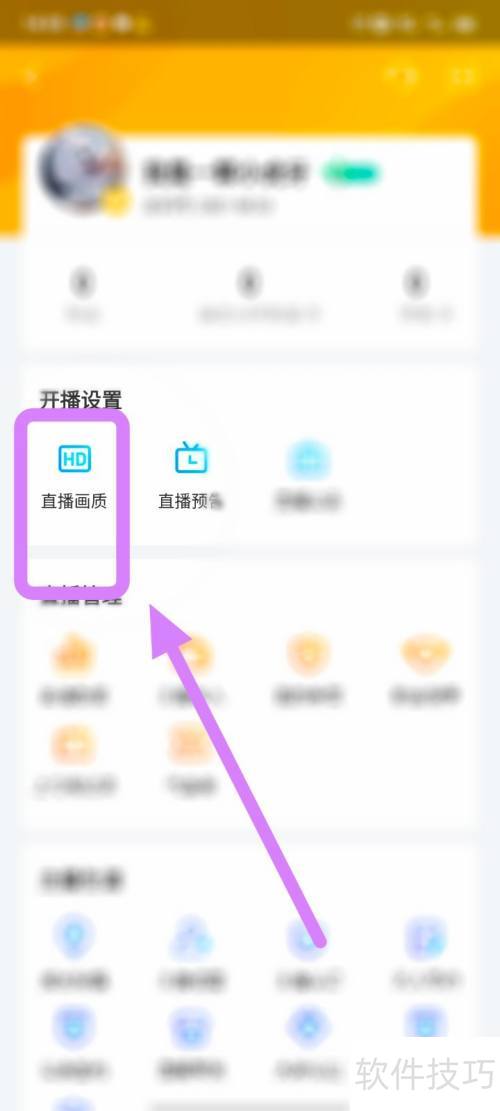 ����ֱ���������ֱ�����ʣ�