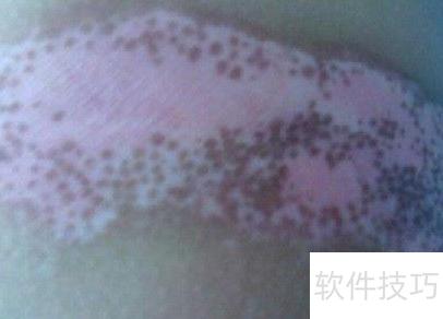 怎样可以减少黑色素生成 ChMkLWkN3uuIWGx9AAAuudktUqEAAGHHAHYAEEAAC7R727.jpg